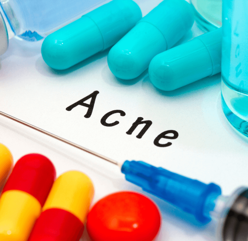 how to clear acne, best way to get rid of acne, acne tips
