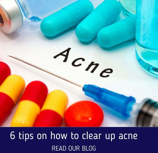 how to clear acne blog post
